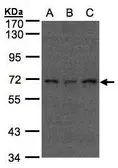 Anti-Apc6 antibody [C1C3] used in Western Blot (WB). GTX102905