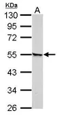 Anti-Retinoic Acid Receptor gamma antibody used in Western Blot (WB). GTX102914