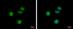 Anti-Retinoic Acid Receptor gamma antibody used in Immunocytochemistry/ Immunofluorescence (ICC/IF). GTX102915