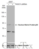 Anti-Nuclear Matrix Protein p84 antibody [C1C3] used in Western Blot (WB). GTX102919