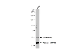 Anti-MMP12 antibody [N3C3] used in Western Blot (WB). GTX102928