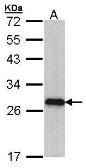 Anti-Myosin Light Chain 3 antibody [N1C3] used in Western Blot (WB). GTX102930