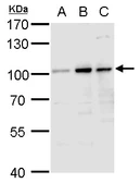 Anti-Aconitase 1 antibody [N1C1] used in Western Blot (WB). GTX102974