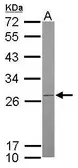 Anti-ATP synthase B1 antibody used in Western Blot (WB). GTX102980