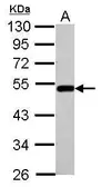 Anti-BLMH antibody [N1C1] used in Western Blot (WB). GTX102984