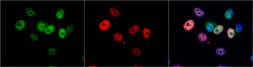 Anti-CDK4 antibody used in Immunocytochemistry/ Immunofluorescence (ICC/IF). GTX102993