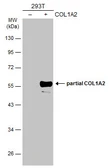 Anti-COL1A2 antibody [C2C3], C-term used in Western Blot (WB). GTX102996