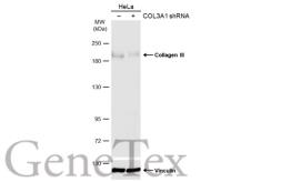 Anti-Collagen III antibody [C2C3], C-term used in Western Blot (WB). GTX102997