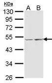 Anti-COX15 antibody [N1C1] used in Western Blot (WB). GTX102999