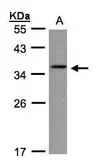 Anti-gamma C Crystallin antibody [N1C3] used in Western Blot (WB). GTX103004