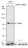 Anti-CSE1L antibody used in Western Blot (WB). GTX103005