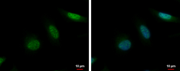 Anti-MCAK antibody [N1N3] used in Immunocytochemistry/ Immunofluorescence (ICC/IF). GTX103013