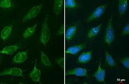 Anti-NNT antibody used in Immunocytochemistry/ Immunofluorescence (ICC/IF). GTX103015
