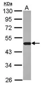 Anti-BHMT antibody used in Western Blot (WB). GTX103037