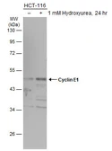 Anti-Cyclin E1 antibody used in Western Blot (WB). GTX103045