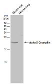 Anti-alpha B Crystallin antibody [N1C3] used in Western Blot (WB). GTX103053