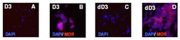 Anti-Mu Opioid receptor splice variant antibody used in Immunocytochemistry/ Immunofluorescence (ICC/IF). GTX10306