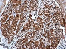 Anti-CRHSP-24 antibody [N1C3] used in IHC (Paraffin sections) (IHC-P). GTX103061