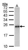 Anti-CRHSP-24 antibody [N1C3] used in Western Blot (WB). GTX103061