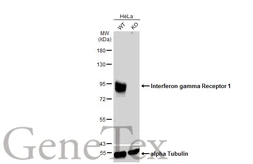 Anti-Interferon gamma Receptor 1 antibody used in Western Blot (WB). GTX103098