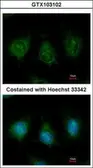 Anti-DAK antibody used in Immunocytochemistry/ Immunofluorescence (ICC/IF). GTX103102