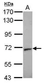 Anti-STXBP2 antibody [N2C1], Internal used in Western Blot (WB). GTX103111