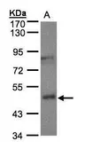 Anti-BBOX1 antibody used in Western Blot (WB). GTX103127
