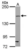 Anti-TJP2 antibody [N2N3] used in Western Blot (WB). GTX103135