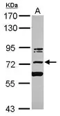 Anti-KIAA0020 antibody [N1C1] used in Western Blot (WB). GTX103160