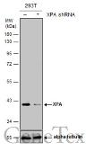 Anti-XPA antibody used in Western Blot (WB). GTX103168