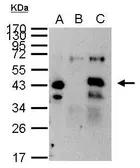 Anti-XPA antibody used in Immunoprecipitation (IP). GTX103168