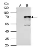Anti-NRF1 antibody used in Immunoprecipitation (IP). GTX103179