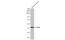 Anti-PAI2 antibody used in Western Blot (WB). GTX103194