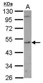 Anti-SHMT1 antibody used in Western Blot (WB). GTX103195