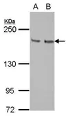 Anti-KIF14 antibody [N1N2], N-term used in Western Blot (WB). GTX103196