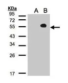 Anti-TAB1 antibody used in Western Blot (WB). GTX103200