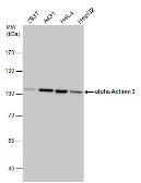 Anti-alpha Actinin 3 antibody used in Western Blot (WB). GTX103216