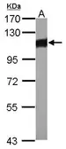 Anti-alpha Actinin 3 antibody used in Western Blot (WB). GTX103216