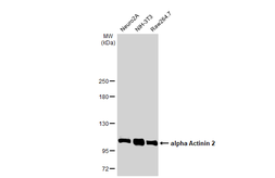 Anti-alpha Actinin 2 antibody [N1N3] used in Western Blot (WB). GTX103219