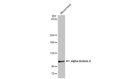 Anti-alpha Actinin 2 antibody [N1N3] used in Western Blot (WB). GTX103219