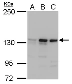 Anti-MSH3 antibody [N1N2], N-term used in Western Blot (WB). GTX103228