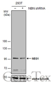 Anti-NBS1 antibody used in Western Blot (WB). GTX103229