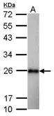 Anti-SOD2 antibody used in Western Blot (WB). GTX103230