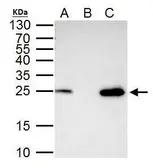 Anti-mtTFA antibody used in Immunoprecipitation (IP). GTX103231