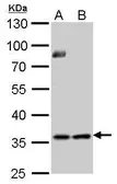 Anti-Thymidylate synthase antibody used in Western Blot (WB). GTX103235