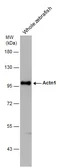 Anti-alpha Actinin 1 antibody [N2N3] used in Western Blot (WB). GTX103240