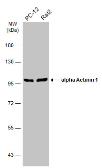 Anti-alpha Actinin 1 antibody [N2N3] used in Western Blot (WB). GTX103240