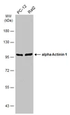 Anti-alpha Actinin 1 antibody [N2N3] used in Western Blot (WB). GTX103240