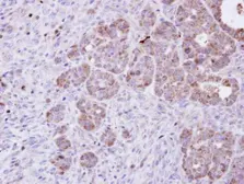 Anti-Amphiphysin antibody [N1N2], N-term used in IHC (Paraffin sections) (IHC-P). GTX103247