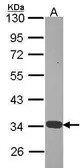 Anti-Annexin IV antibody used in Western Blot (WB). GTX103249